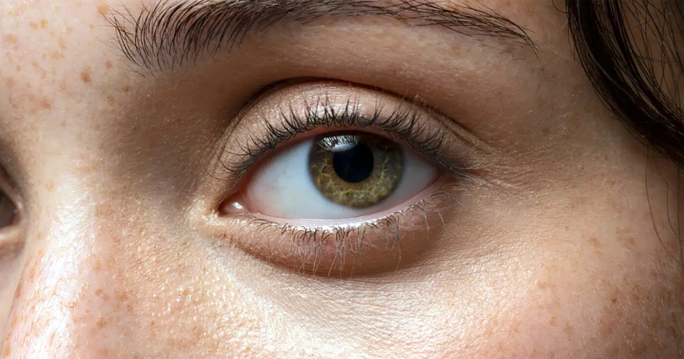 Portraits, Anxiety and Eye Contact